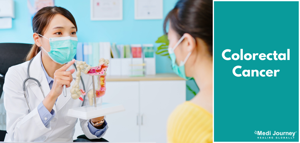 Colorectal Cancer: Know Everything from Symptoms to Treatment